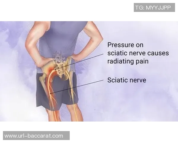 专家解读坐骨神经痛成因及治疗方法大多数患者可避免手术治疗